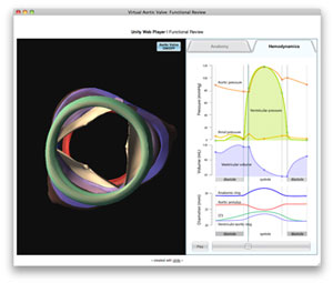 screen capture of Virtual Aortic Valve Functional Review module